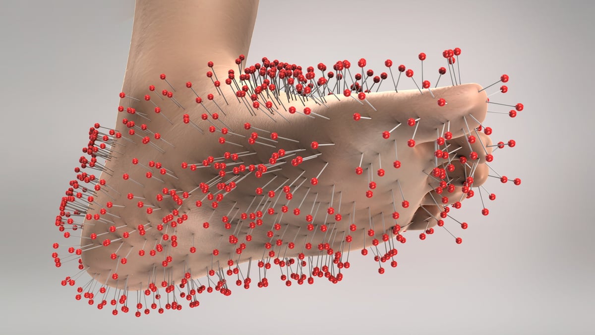 Peripheral Neuropathy Foot Pain Numbness