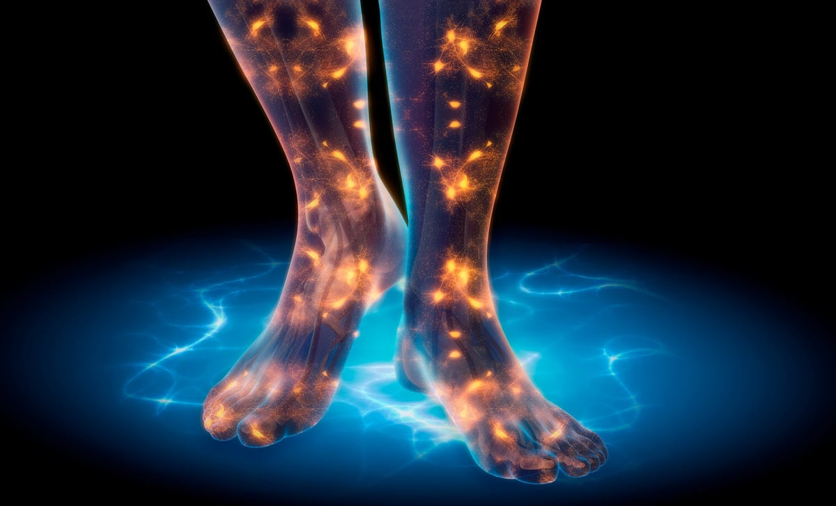 Restless Legs Syndrome RLS - Highlighted nerves showing neuropathic foot and leg pain - 3D illustration