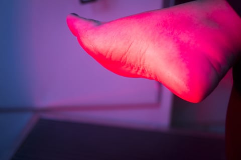 Patient foot in red physiotherapy heat treatment under hot light.